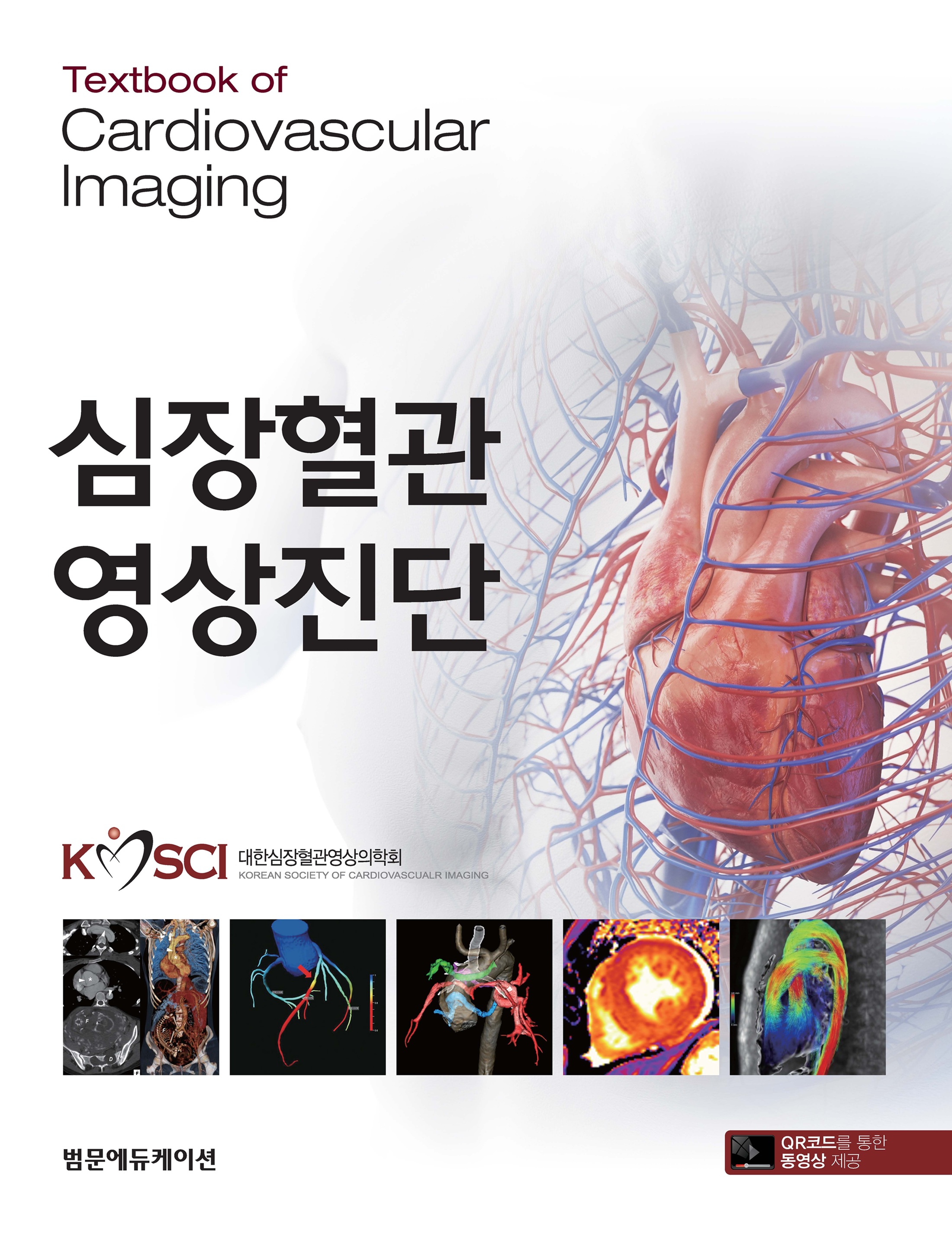 심장혈관영상진단